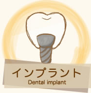 インプラント